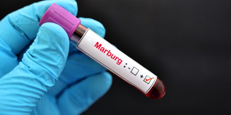 Марбург вирусы Руандада дендеп барады
