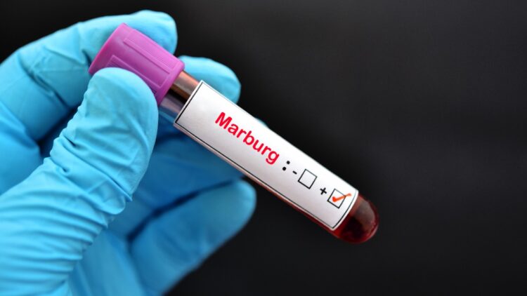 Марбург вирусы Руандада дендеп барады