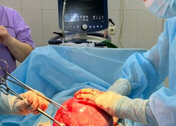 Алматы дәрігерлері 6 келі жатыр миомасын алып тастады