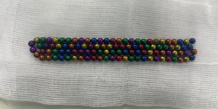 Алматыда 2 жасар бала 105 магнит жұтып қойды