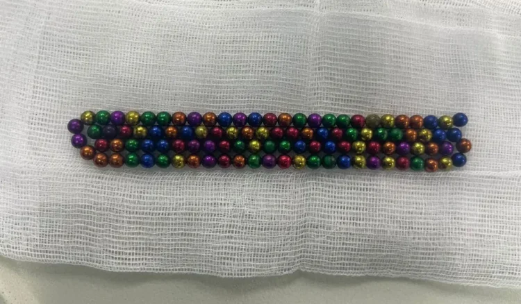 Алматыда 2 жасар бала 105 магнит жұтып қойды