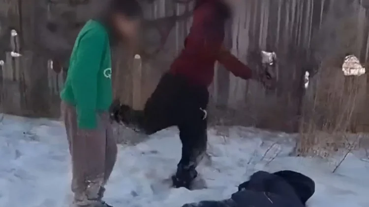 Семейде соққыға жығылған бала жабық бас-ми жарақатын алған