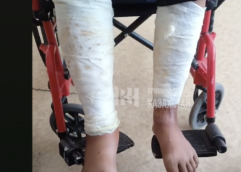 В Карагандинской области подросток поджег сверстника, облитого бензином