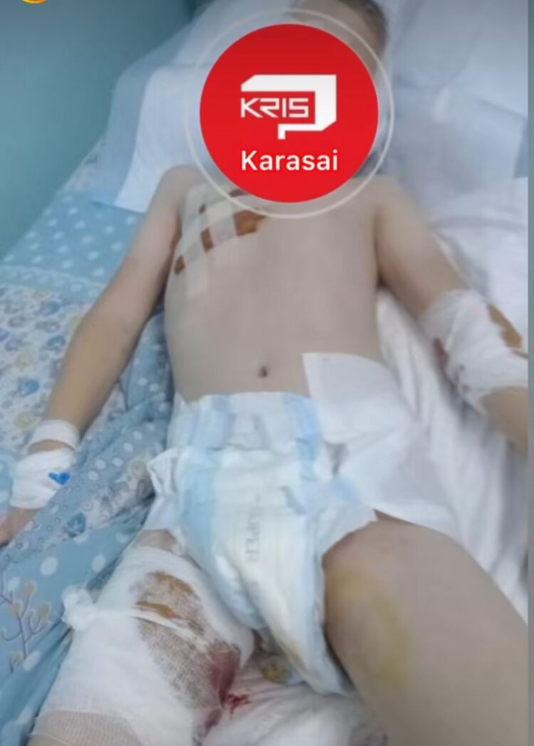 Истерзанного собаками мальчика перевели в областную клинику: состояние стабильно тяжелое