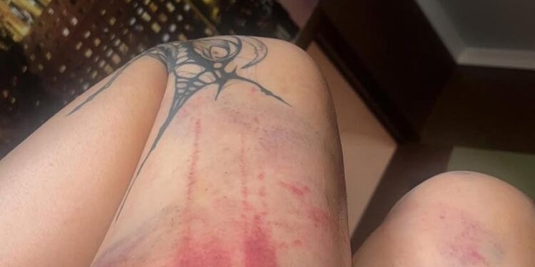 Рэпер Qurt оказался в центре скандала: его жена заявила о жестоком избиении