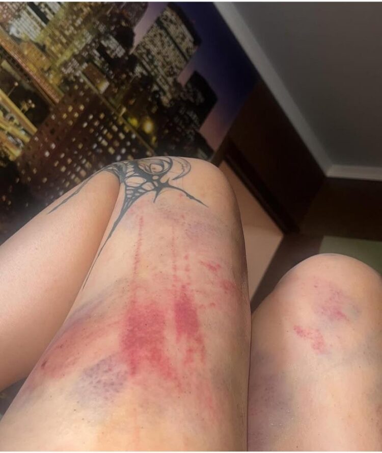 Рэпер Qurt оказался в центре скандала: его жена заявила о жестоком избиении