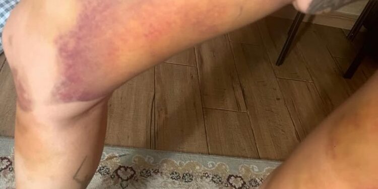 Qurt лақап атымен танымал рэпер отбасылық жанжал ортасында қалды