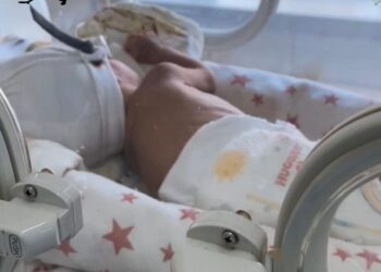 Успех лечения: Малышка весом 870 граммов выписана из Алматинской многопрофильной клинической больницы