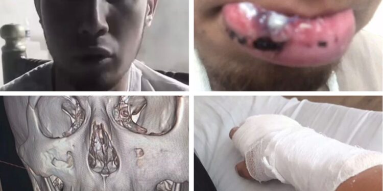 Түркістан облысында отбасыға шабуыл жасалды: полиция тексеру бастады