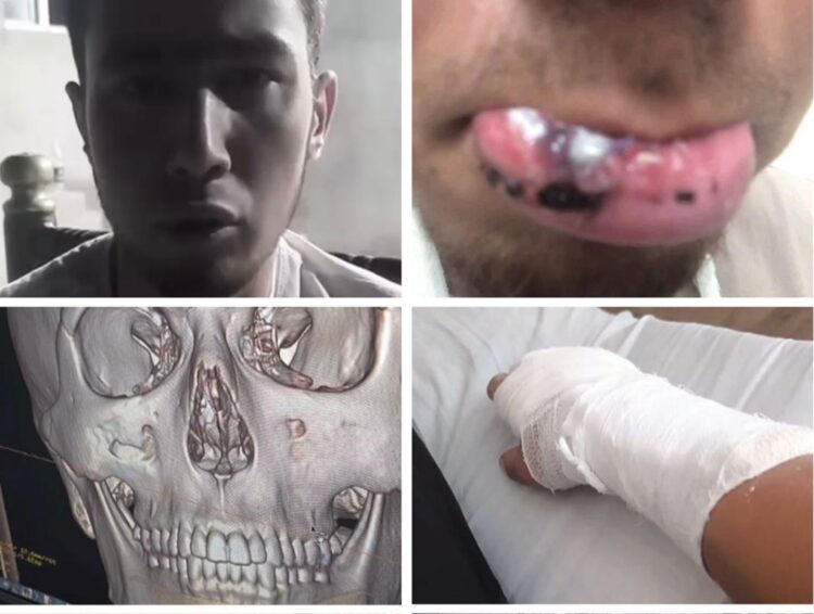 Түркістан облысында отбасыға шабуыл жасалды: полиция тексеру бастады