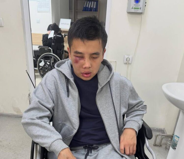 В Алматы толпа мужчин жестоко избила 18-летнего парня: мать требует справедливости