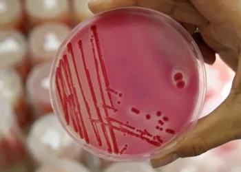 Арқалықтағы жаппай улану себебі анықталды — сальмонелла қызметкерлерден табылды