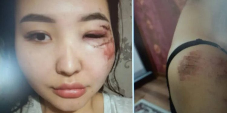 В Атырау начался суд по делу об избиении блогерши Куралай Болатовой