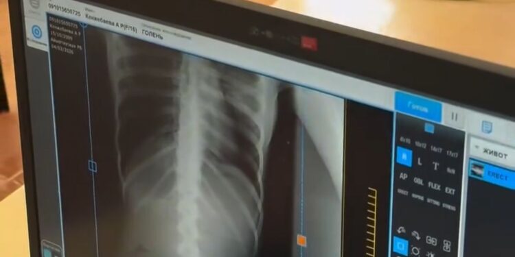 Мектеп дәретханасында уланған жасөспірім жансақтау бөлімінде жатыр