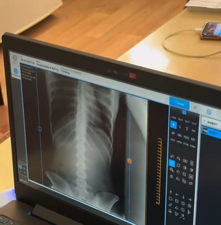 Мектеп дәретханасында уланған жасөспірім жансақтау бөлімінде жатыр