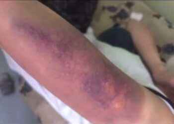 В Караганде подростки избили сверстницу: двое помещены в ИВС