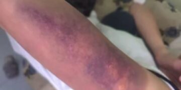 В Караганде подростки избили сверстницу: двое помещены в ИВС