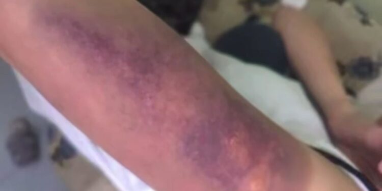 В Караганде подростки избили сверстницу: двое помещены в ИВС