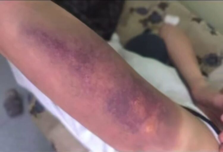 В Караганде подростки избили сверстницу: двое помещены в ИВС